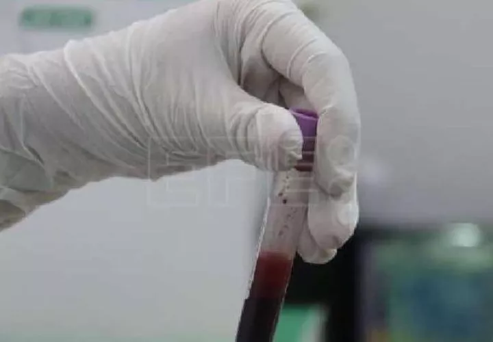 Pruebas médicas para atletas en Panamá. Foto: EFE