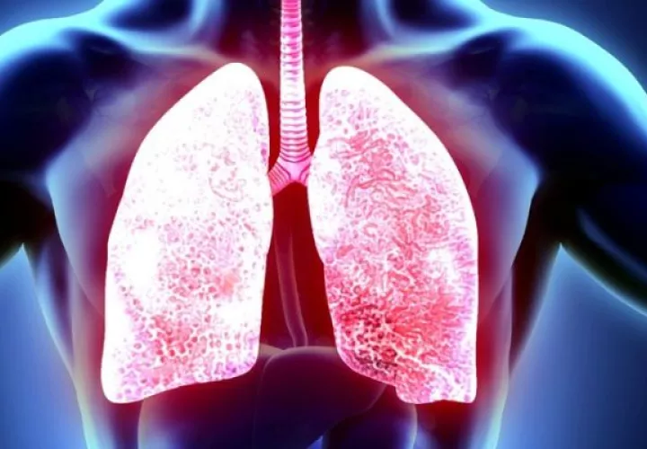 La tuberculosis es ocasionada por la bacteria mycobacterium tuberculosis. Foto Pixabay