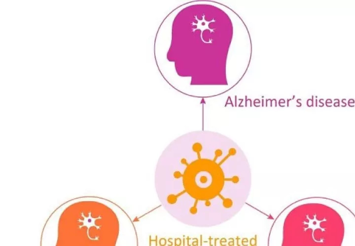Las infecciones juegan un papel importante en el desarrollo de algunas enfermedades neurodegenerativas. Foto: EFE