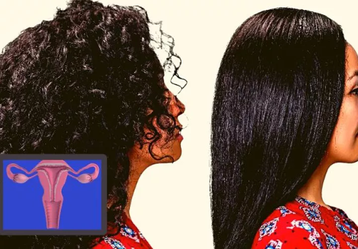 No se encontraron asociaciones entre el cáncer de útero y﻿ el uso de tintes para el cabello.