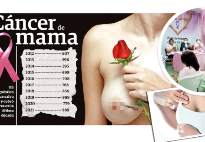 En el sexo femenino, más del 50% de los casos se encuentran diagnosticados por cáncer de mama, cérvix y cuerpo uterino. Foto: Archivo