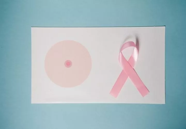 La enfermedad tiene un impacto en la autoestima de las pacientes. Foto: Ilustrativa / Pexels