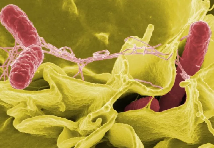 Alrededor de 31 millones de personas sufren un episodio de sepsis cada año en el mundo. Foto: Pixabay