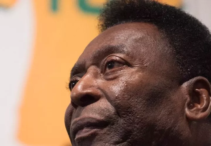 Pelé tiene 82 años. Foto:EFE