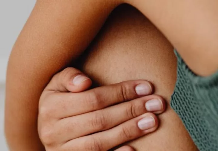 Pueden aparecer en el abdomen, el pecho, las caderas, la zona lumbar y los muslos.  Foto: Ilustrativ / Pexels