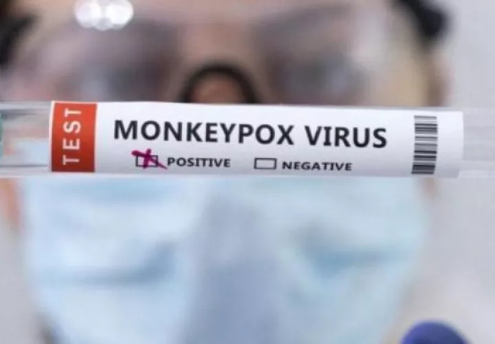 Panamá mantiene una alerta sanitaria en todo el país por la viruela del mono. Foto: Cortesía
