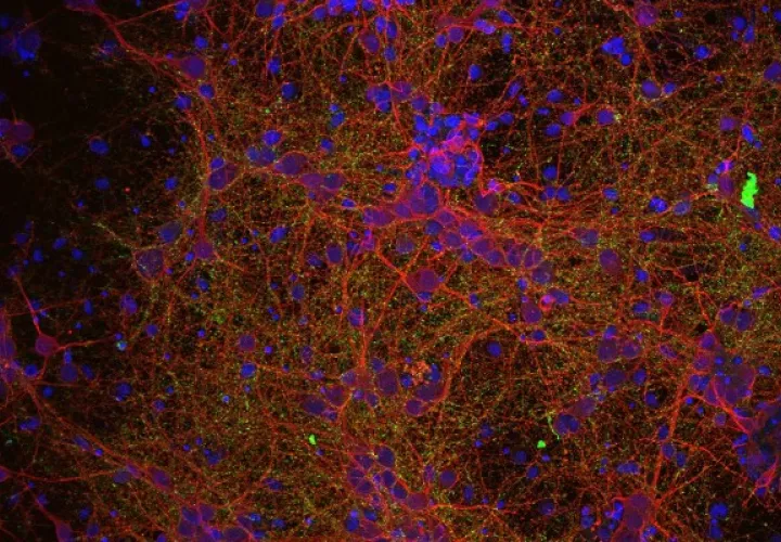 Centros de investigación de seis países europeos han lanzado un proyecto pionero en el mundo para tratar de encontrar tratamientos eficaces contra las lesiones medudales.. Foto: EFE