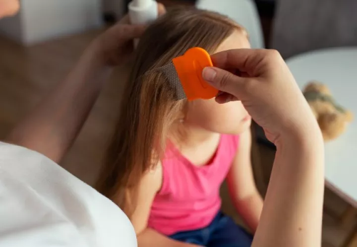 Los piojos son cada vez más resistentes a los compuestos químicos. Foto ilustrativa / Freepik. 
