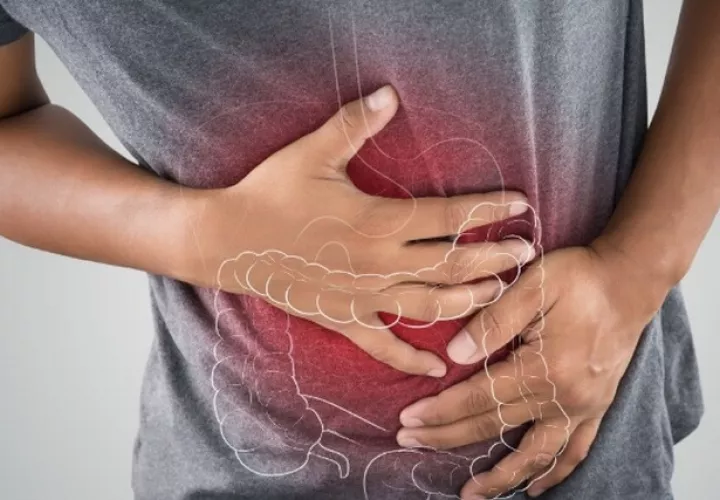 Algunos factores indicarán si se requiere hacer colonoscopia antes de los 45. Foto: Pixabay
