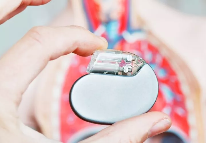 Los marcapasos  se usan para pacientes con  insuficiencia cardíaca.