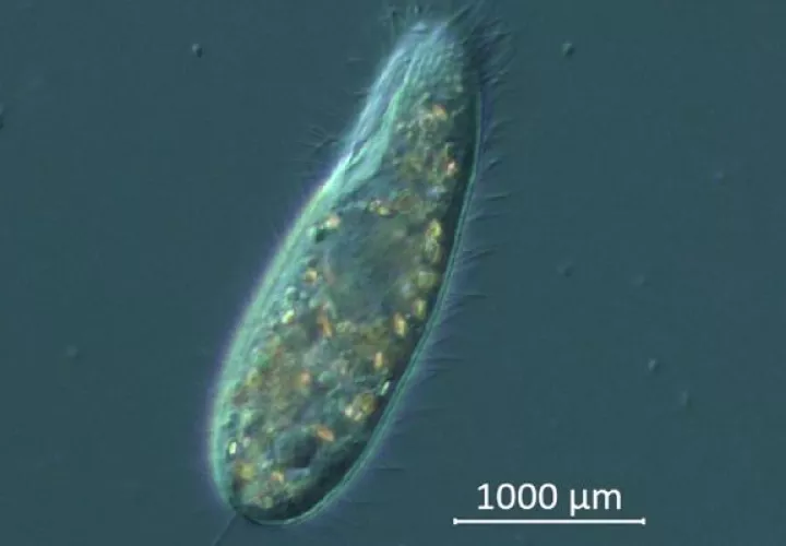 El organismo unicelular Philaster apodigitiformis estaría acabando con los  erizos Diadema. Foto: EFE
