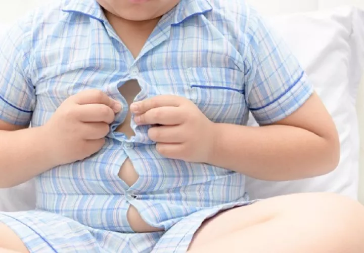  La  obesidad es una enfermedad crónica con consecuencias importantes para la salud. Foto: Ilustrativa / Pexels