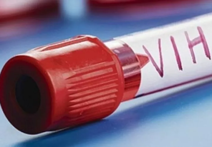 En el país hay más de 20,000 personas con VIH.