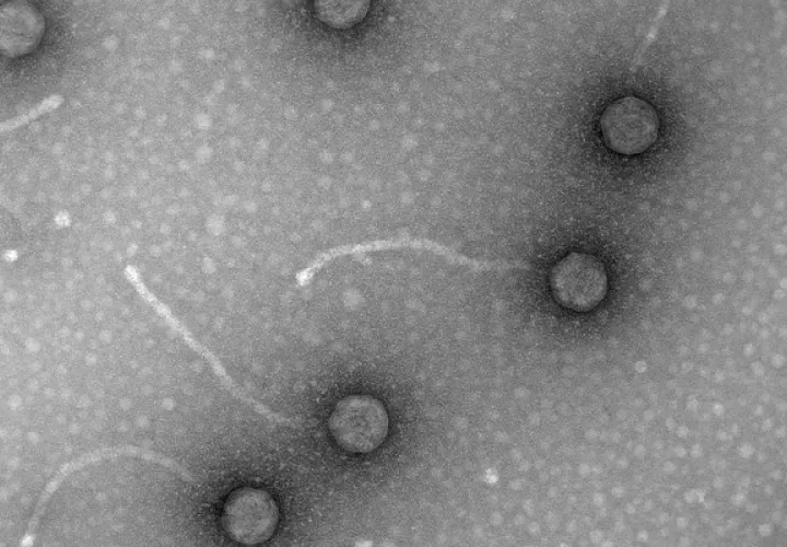 Micrografías de fagos, virus de bacterias, obtenidas en el laboratorio de Virología Ambiental y Biomédica del Instituto de Biología Integrativa de Sistemas (UV-CSIC).  Foto: EFE
