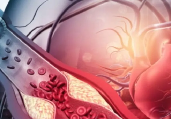 Llevar una vida más saludable permite tener arterias más sanas. Foto: www.istockphoto.com