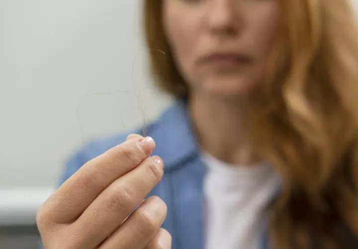 Si la pérdida supera los 120 cabellos  se puede hablar de alopecia. Ilustrativa / Freepik