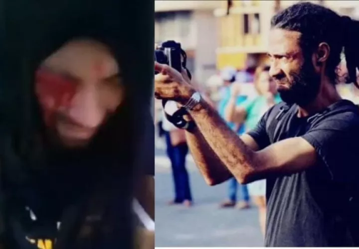 Exigen justicia en el caso de agresión del fotógrafo Aubrey Baxter. Foto: Cortesía