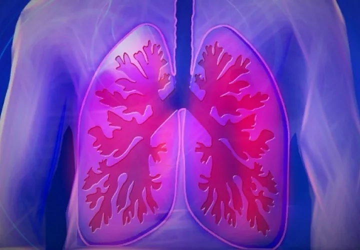 Con los avances tecnológicos el cáncer de pulmón ha dejado de ser una sentencia de muerte. Foto: Pixabay 