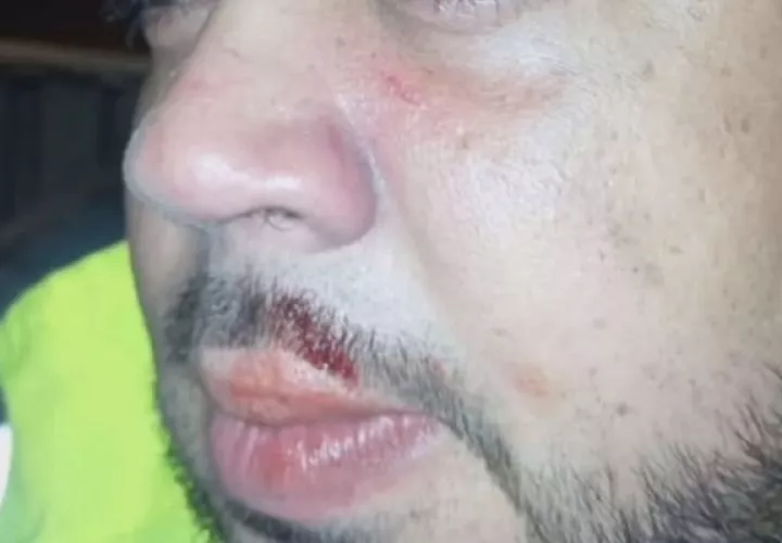 Ante estos casos de agresión se ha solicitado a la Policía Nacional que intervenga. Foto. Diomedes Sánchez