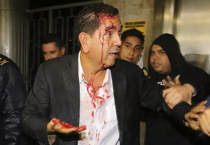 El diputado por el Partido Nacional Antonio Rivera es resguardado después de ser agredido por simpatizantes del gobernante Partido Libertad y Refundación (Libre), en el Congreso Nacional en Tegucigalpa .