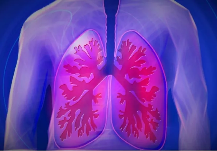 El cáncer de pulmón principalmente ocurre en las personas de edad avanzada. Foto: Pixabay