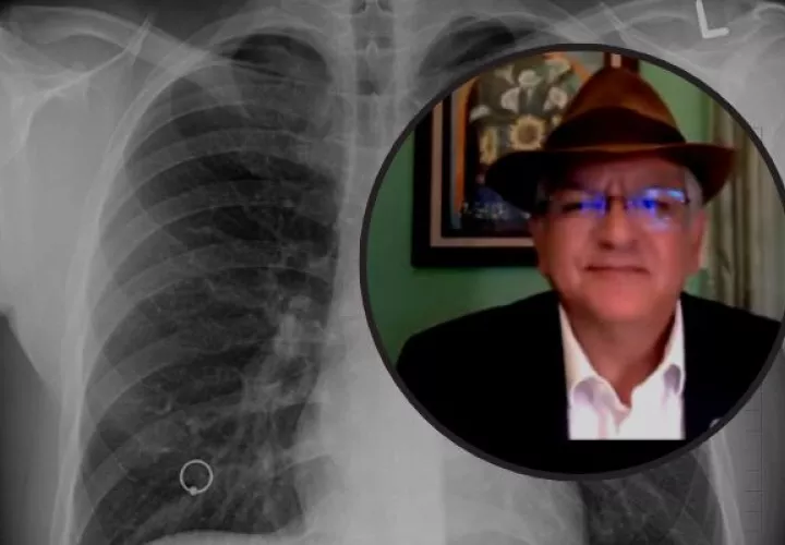 Doctor Alberto Colorado, integrante de la Coalición de TB de las Américas. Foto: Cortesía