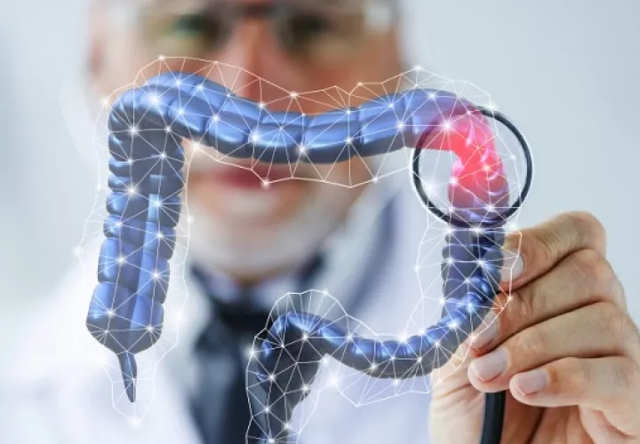 El cáncer de colon puede aparece a cualquier edad. Foto: Ilustrativa / Freepik