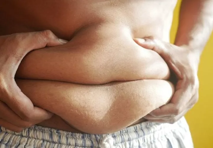 La obesidad no es falta de voluntad.  Foto: Pexels