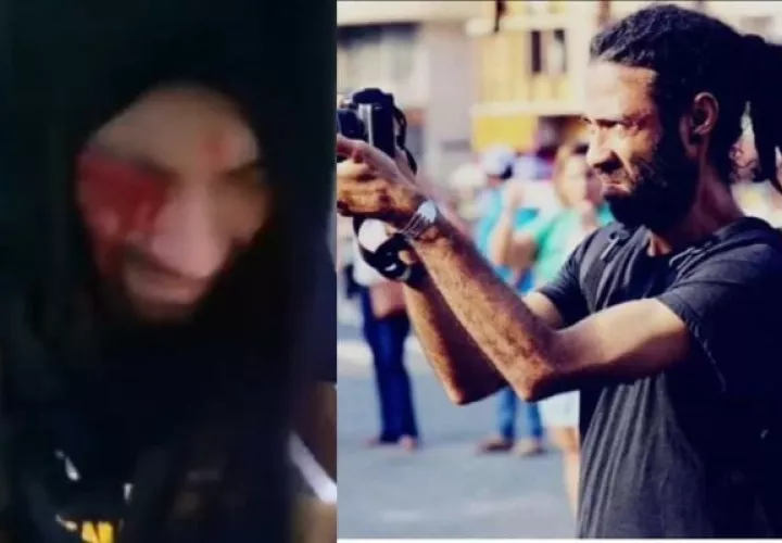 El informe precisa que el ataque más grave se produjo contra el fotoperiodista independiente Aubrey Baxter. 