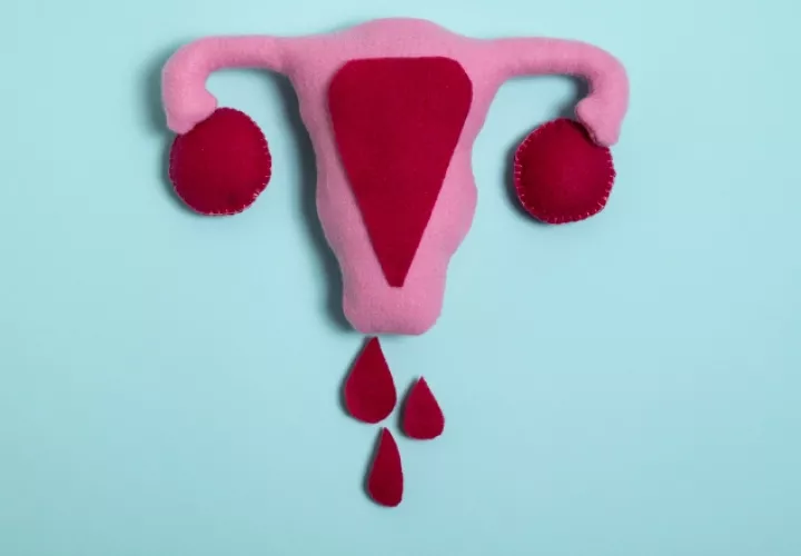 Los coágulos preocupan a muchas mujeres. Foto: Freepik