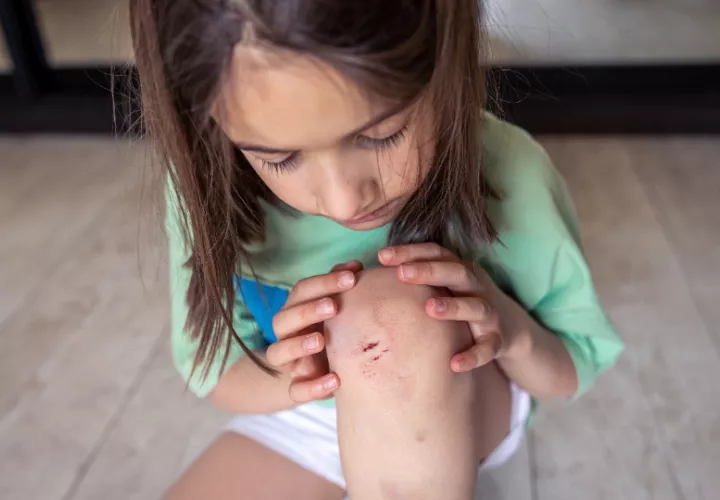 Los niños terminan con golpes y hematomas por accidentes en escaleras y ventanas. Foto:  Ilustrativa / Freepik