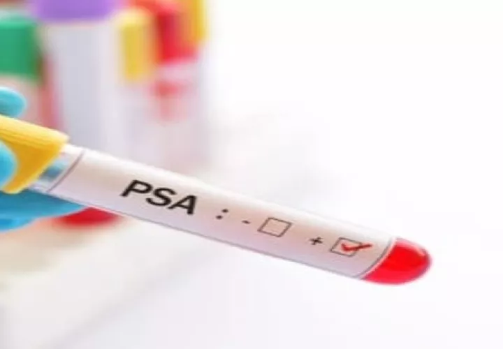 El exámen del PSA es una de las formas de diagnósticar la enfermedad/ foto cortesía 
