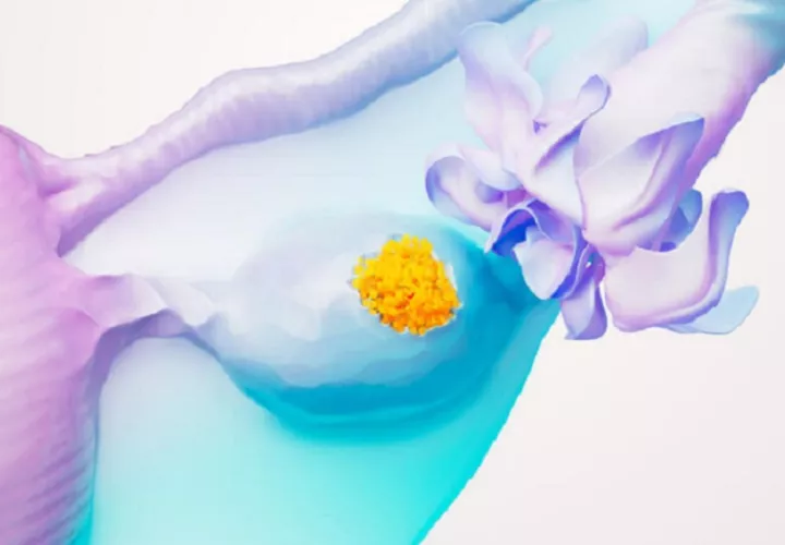 En los últimos años, el tratamiento del cáncer de ovario ha experimentado avances significativos gracias a la investigación y el desarrollo de terapias innovadoras. Cortesía