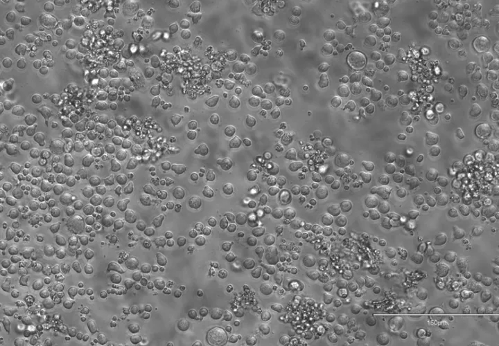Células madre hematopoyéticas de ratón cultivadas en el día 12, lo que permite estudiar su biología en etapas muy tempranas.  Foto: EFE