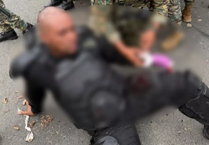 Oficial resultó herido en el sector de Arimae. Foto: Cortesía