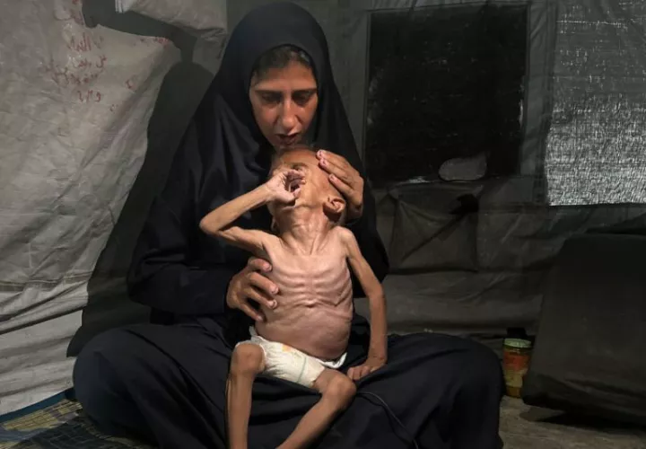 La crisis por desnutrición en Gaza ganó visibilidad con imágenes como las del pequeño Mohamed Motawaq. Foto: EFE