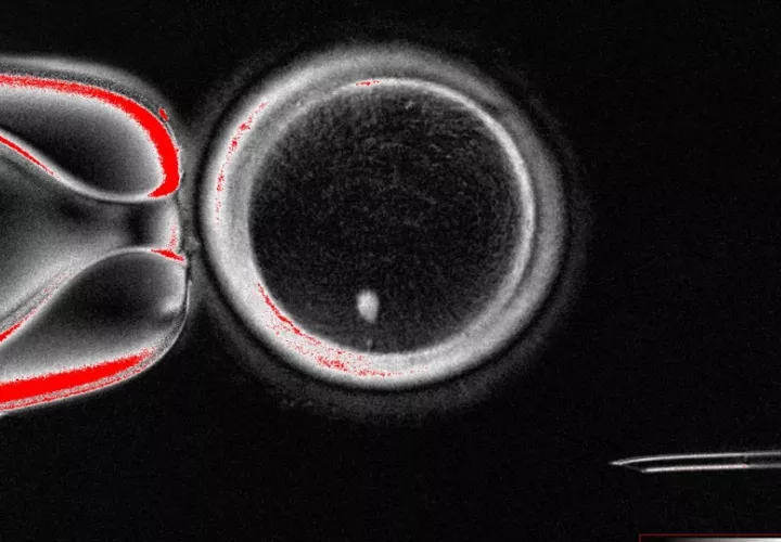 Ovocito humano con transferencia nuclear de células somáticas con huso visible (punto brillante en el interior) antes de la fecundación. Foto: EFE