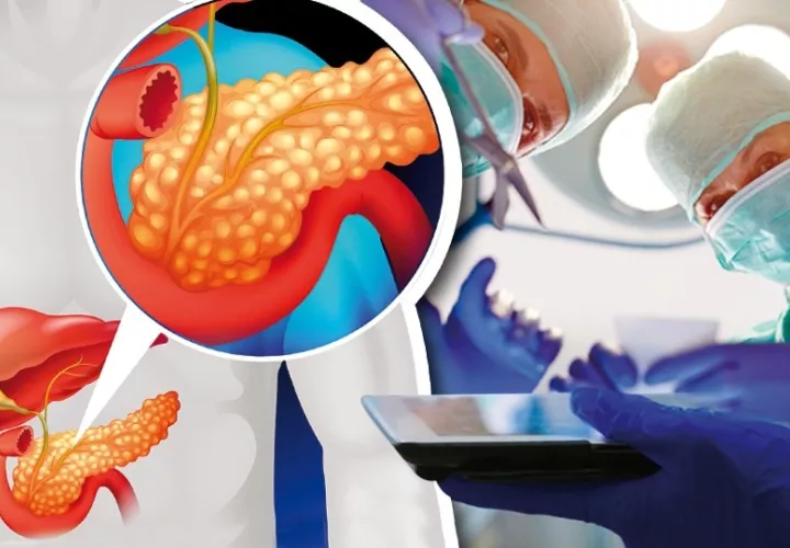 El cáncer de páncreas es muy agresivo. Foto: Ilustrativa / Freepik