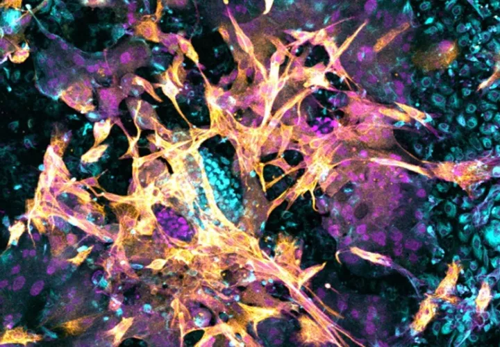 Imagen microscópica de un embrión humano de 14 días que se ha implantado en el nuevo modelo endometrial. Foto: Matteo Molè/EFE