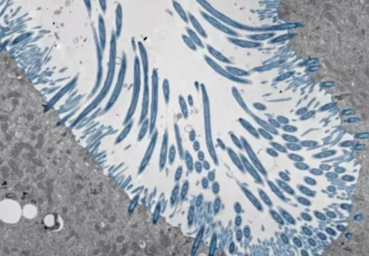 Micrografía electrónica de organoides epiteliales nasales humanos. Foto: EFE