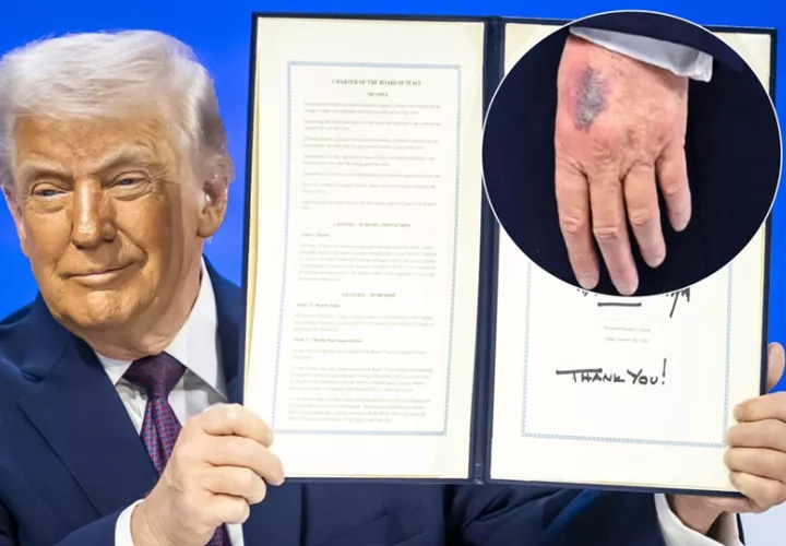 Trump también ha dicho que toma mucha aspirina "por superstición". Foto: EFE