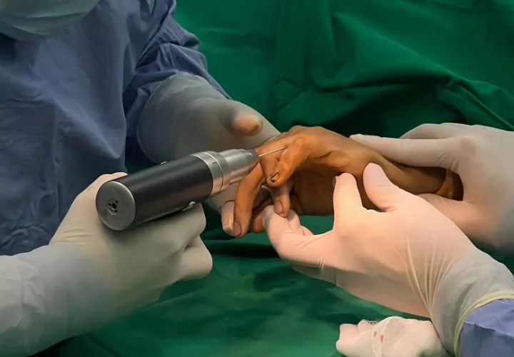 mano_cirugia_veraguas_1.jpg