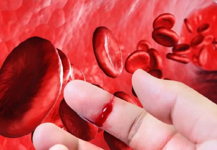 Panamá presenta sus primera guías nacionales para la hemofilia, fortaleciendo un diagnóstico temprano. 