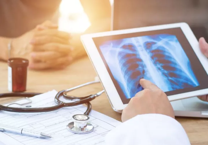 Otros factores, además de fumar, provocan este tipo de cáncer.  