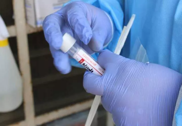 Continúan los ensayos clínicos de las vacunas contra el coronavirus. Cortesía 