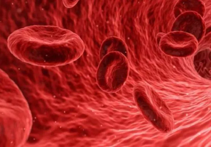 La enfermedad tromboembólica venosa engloba dos condiciones.  Pexels