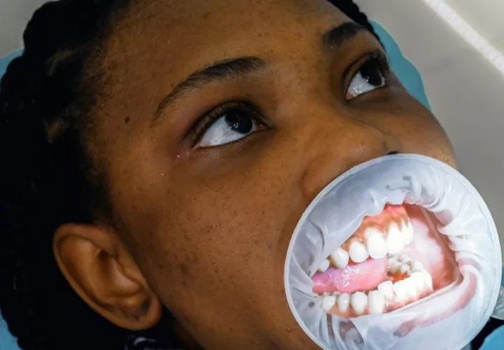 Cuidar los dientes es importante. Pexels