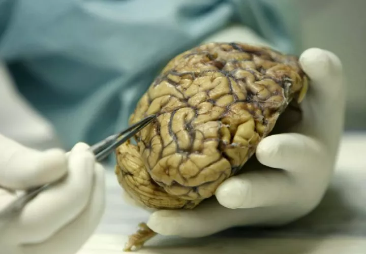 ¿Será posible utilizar la tecnología en favor de nuestro cerebro? EFE