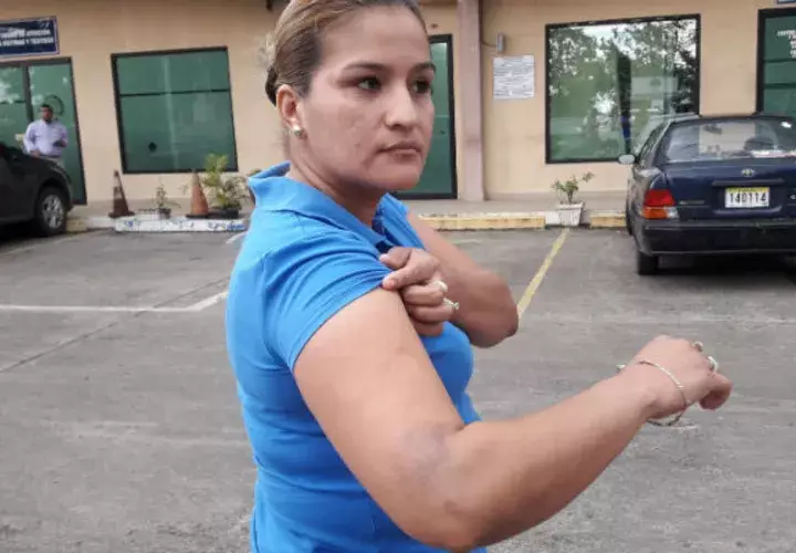 La otra mujer fue golpeada en el brazo por policías en Chiriquí. 