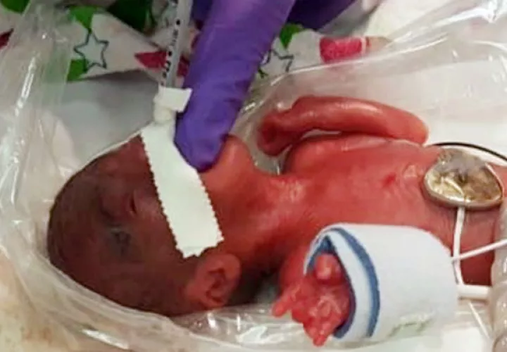 La familia de la bebé autorizó que se compartiera esta historia pero solicitó permanecer en el anonimato, según el hospital.
